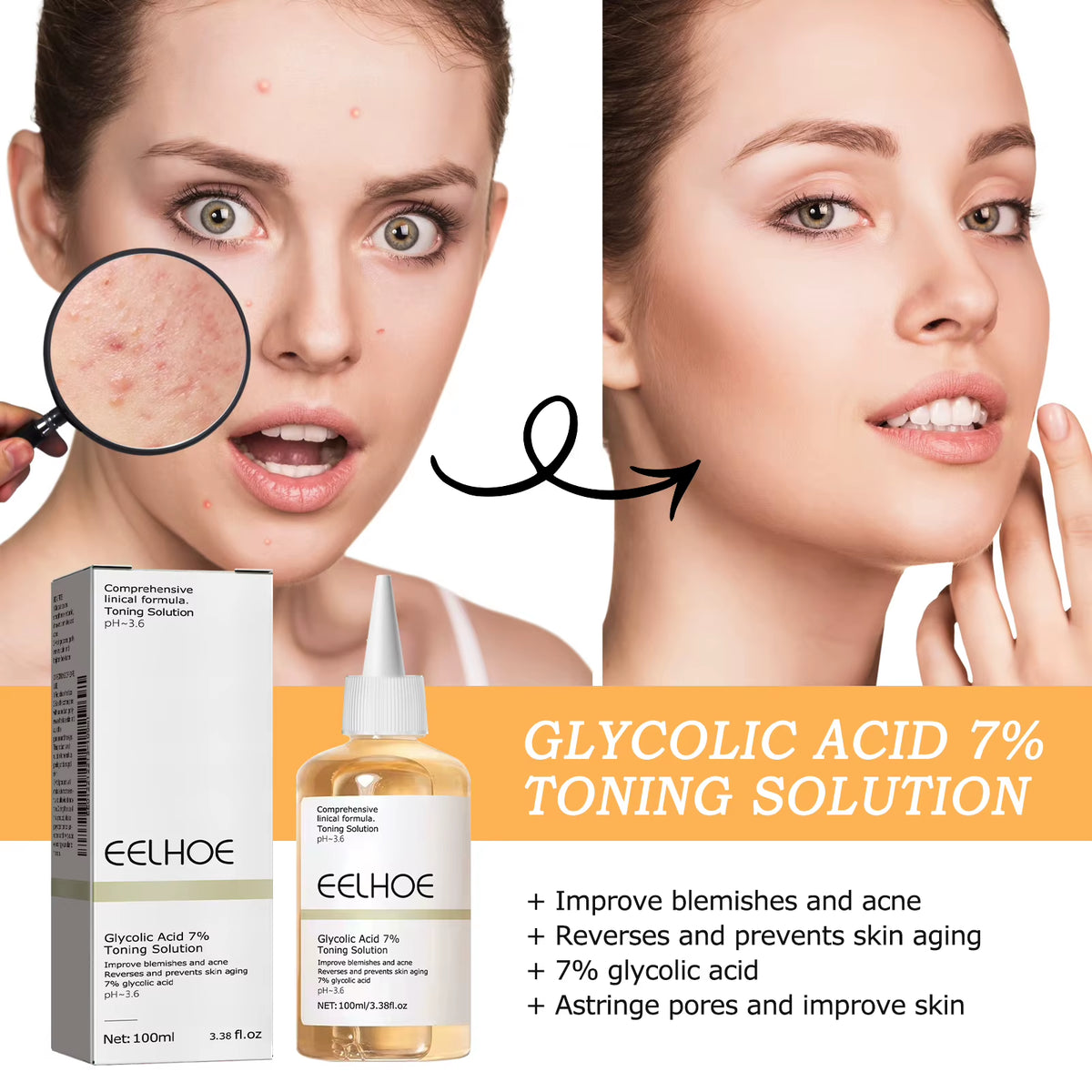 Glycolic Acid 7% Toning Solution Exfoliating Toner Pore Minimizer Skin Smoothing Brightening Even Tone Daily Facial Skincare