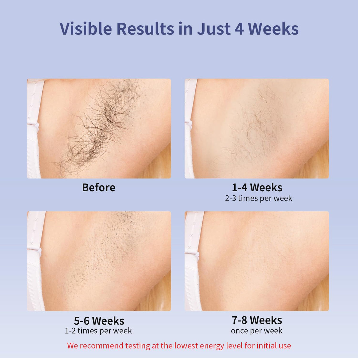 IPL Hair Removal Device, Ice Cooling Protection Laser Permanent Whole Body Hair Remover for Home Use Women and Men (Bule)