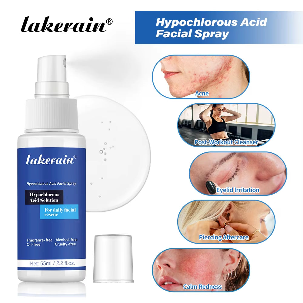 Hypochlorous Acid Facial Spray Reduce Redness Breakouts Soothing for Daily Facial Rescue Calm Redness Skin Care Products