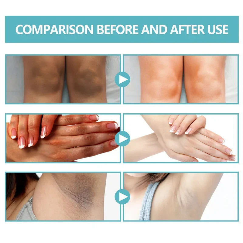 Underarm Creams for Dark Skin Body Crotch Armpit Moisturizing Korean Skincare Products 50G